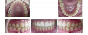 Des photos dont le dentiste a besoin pour un devis en cas d'un traitement cosmétique.